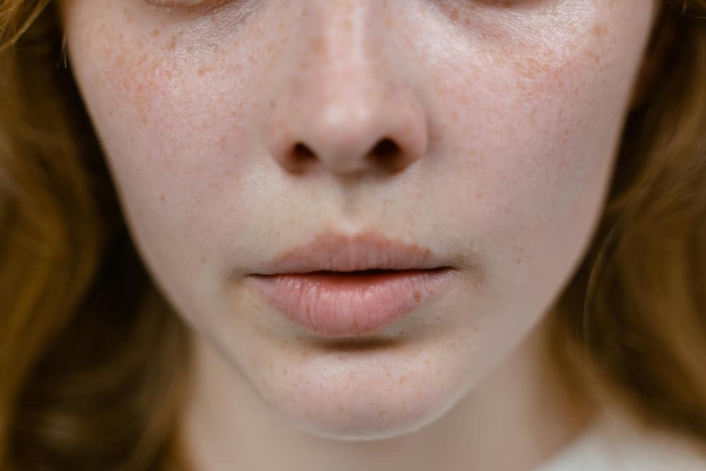 Skin Quality